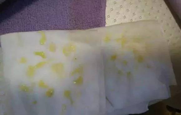 如何排残奶断乳6年,乳房里的残奶需要排吗