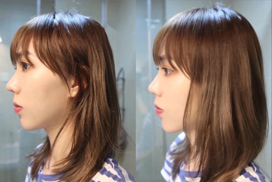 发量少发际线高怎么补救男,额头发际线太高会影响颜值