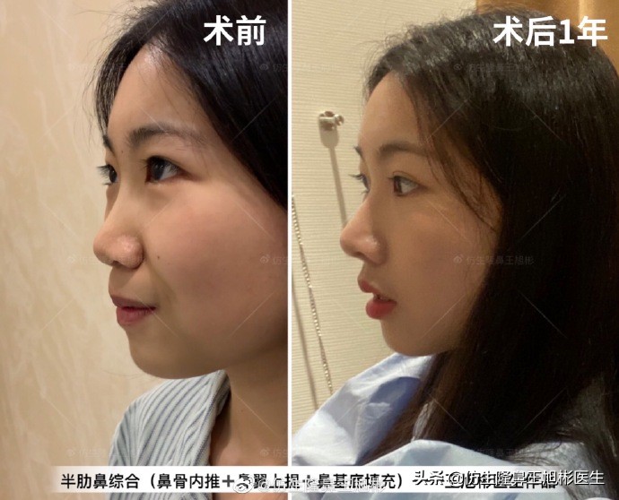 被鼻子封印的颜值,那些被鼻子封印的颜值