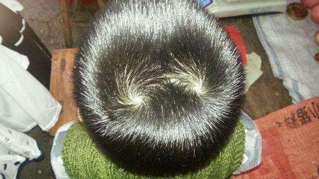 宝宝头旋不同数量和位置，暗示不同人生，很多人想错了