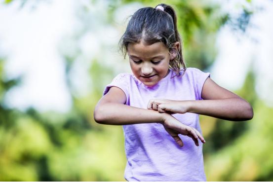 紫外线过敏皮炎擦什么软膏,夏天容易紫外线过敏是什么原因