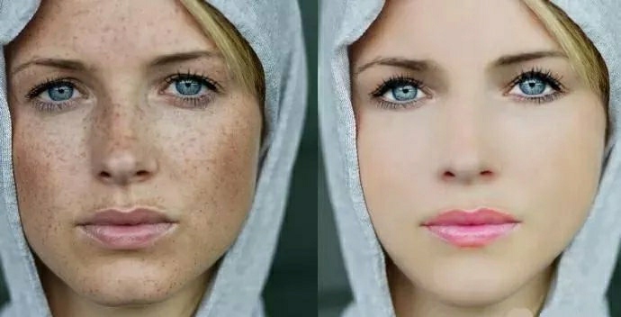 如何祛斑10种祛斑的简单最佳方法,祛斑方法教你如何祛斑最快最有效