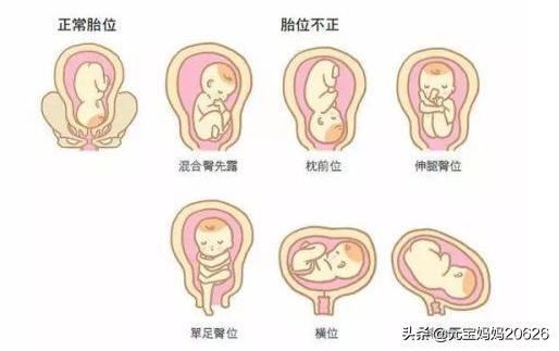 孕33周宝宝发育妈妈变化注意事项,孕34周胎儿发育标准大概有几斤