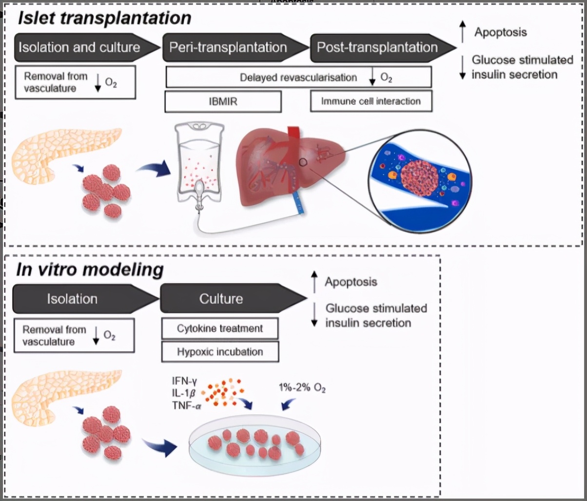 间充质干细胞治疗糖尿病,糖尿病人可以做胰岛干细胞手术吗