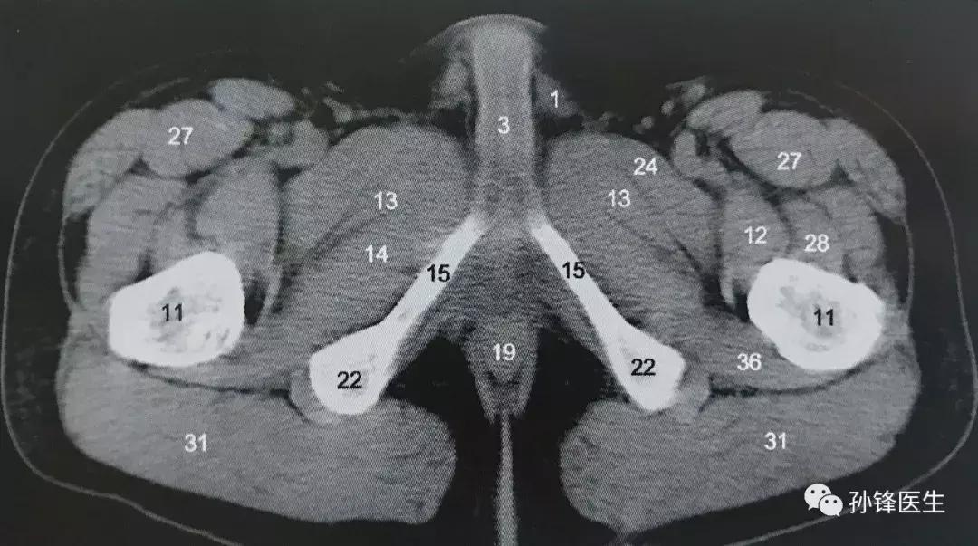 医学笔记︱男性会阴部的肌肉系统（中肛管水平）：（下）