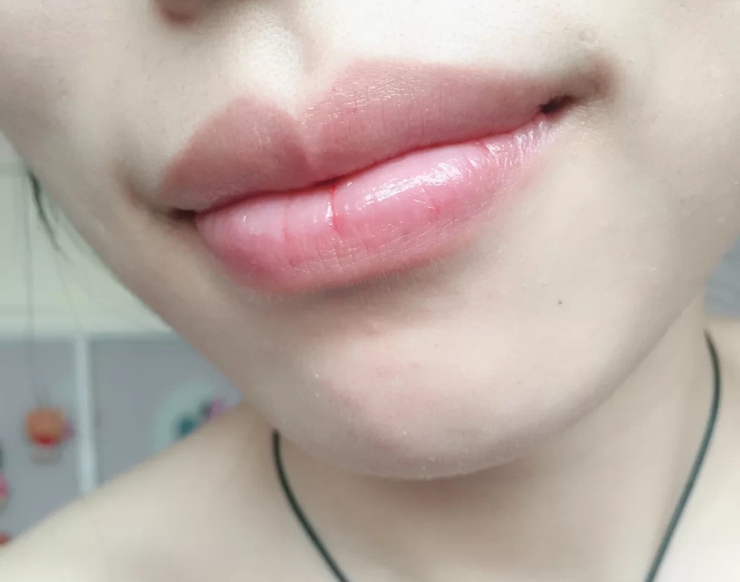 嘴唇有唇纹该如何淡化,嘴唇干唇纹深怎么改善