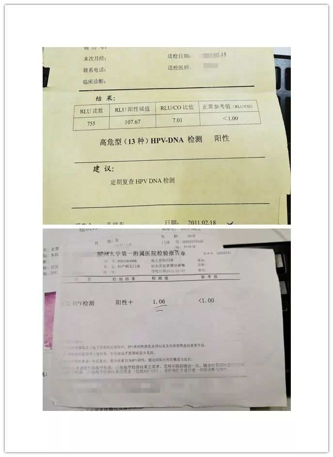 预防宫颈癌hpv疫苗价格,hpv可以预防宫颈癌吗