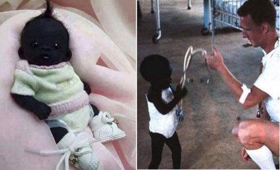 地球上最黑的孩子后来怎么样了,世界上最黑的婴儿黑得超乎想象