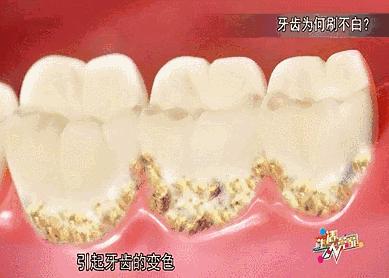 最好用的牙膏排行榜前十名,选哪个牌子的牙膏最安全好用