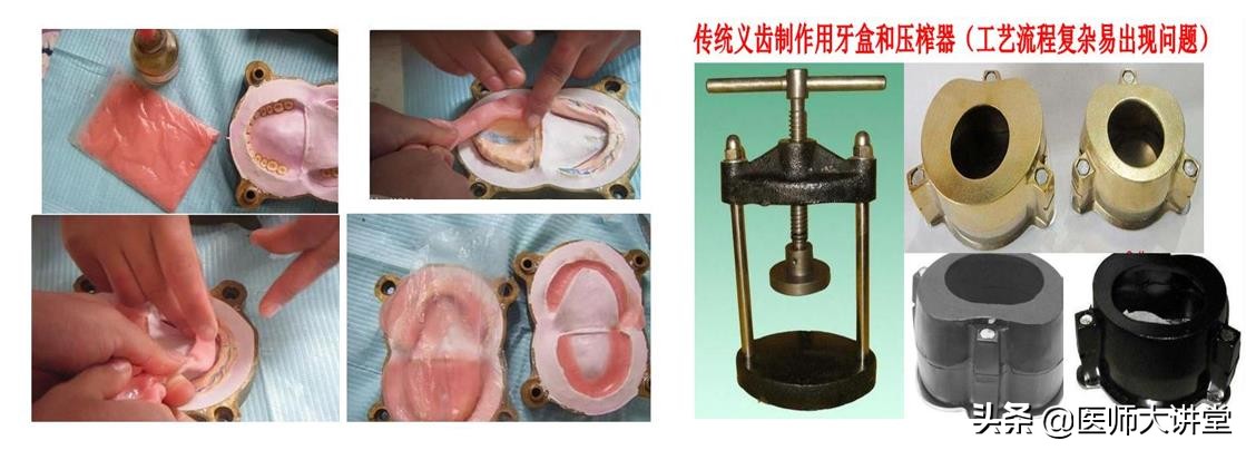 金属假牙托牙制作全过程,自己在家做树脂假牙新技术