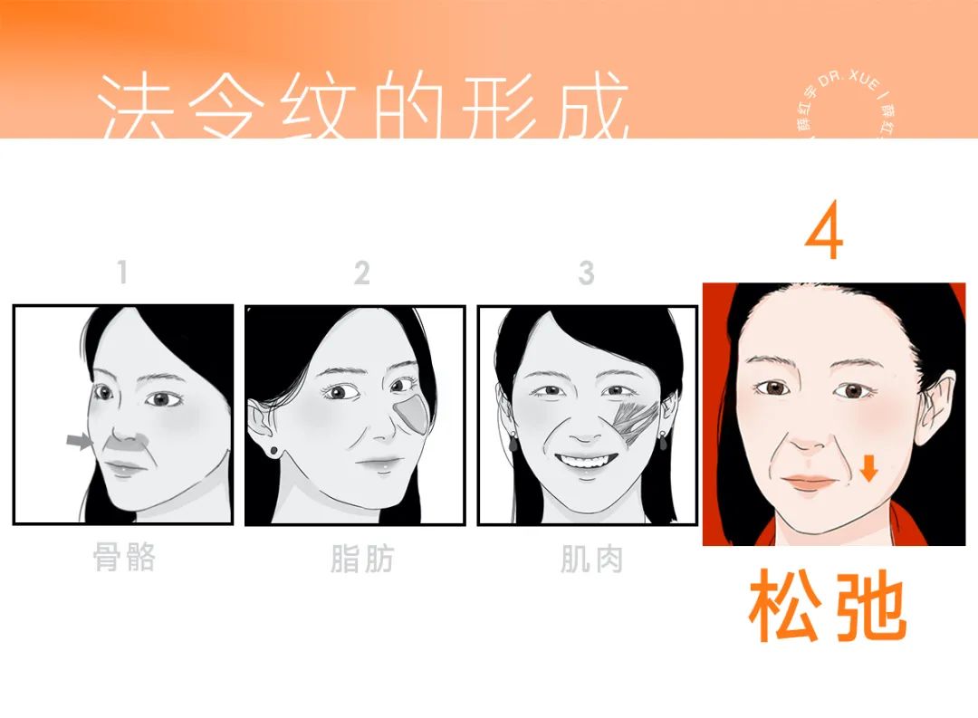 法令纹怎么改善脸部衰老,改善法令纹按摩手法视频