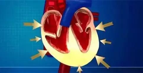 心律不齐是否可以治愈,心律不齐有多大问题能治愈吗