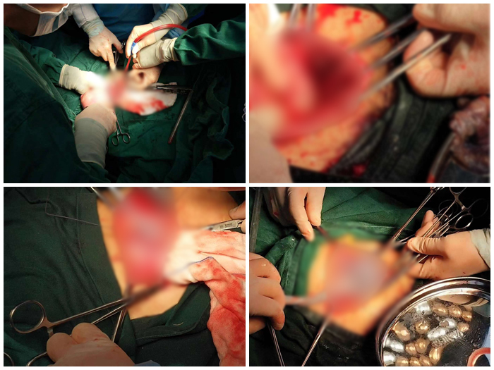 河南孕妇大出血,河南大出血孕妇现在最新进展