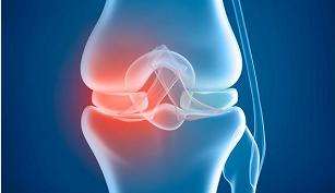 科普：把这篇转给关节有损伤、不舒服的家人当礼物吧