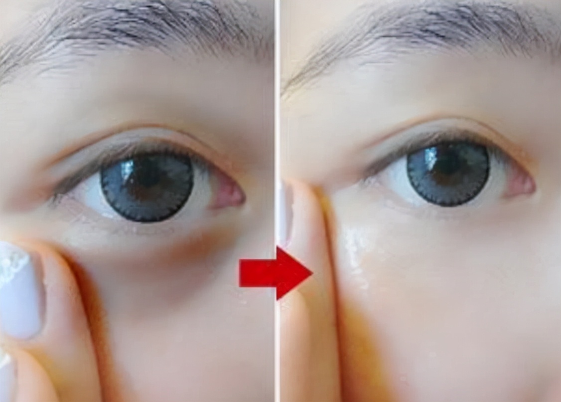 什么牌子的眼霜最好用最有效,平价眼霜排名十大公认好用的眼霜