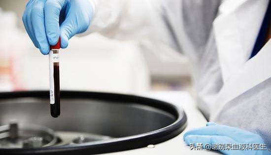 再障输脐带血几天见效,输脐带血治再障效果