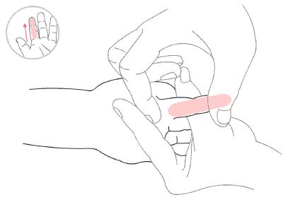 小儿腹泻怎么调理好得快,小儿腹泻的辨证与推拿