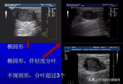 年轻女孩最关心哪些问题,了解女朋友的基本问题笔记