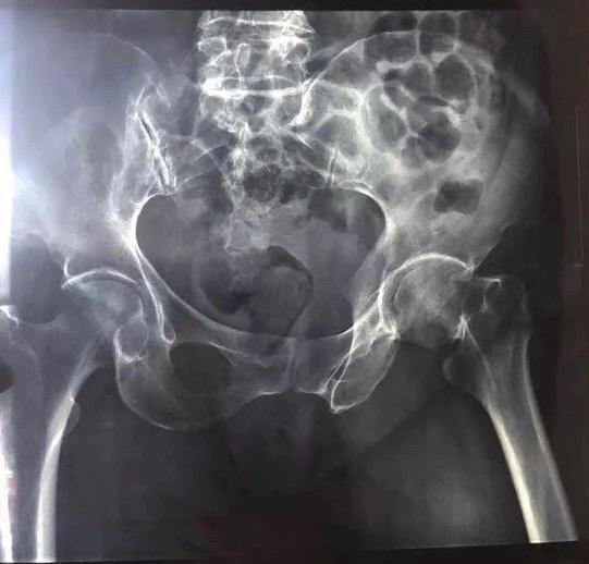 「后续」常州保洁员制止扔垃圾被打小伙道歉并支付6万元手术费