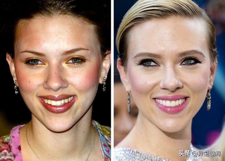 做牙齿美白的明星,明星的牙齿美白