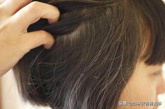 为什么年纪轻轻就白了头发,疏肝补肝血汤治白发