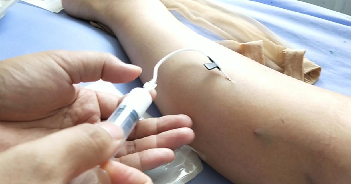 隔壁老王说静脉曲张可以打针治疗！这是真的吗？