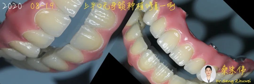 从小白到资深大咖,从小白到大师的蜕变