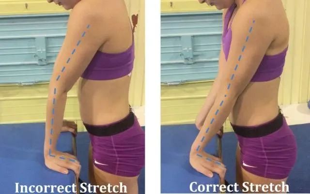 女性肘超伸,肘超伸锻炼危害