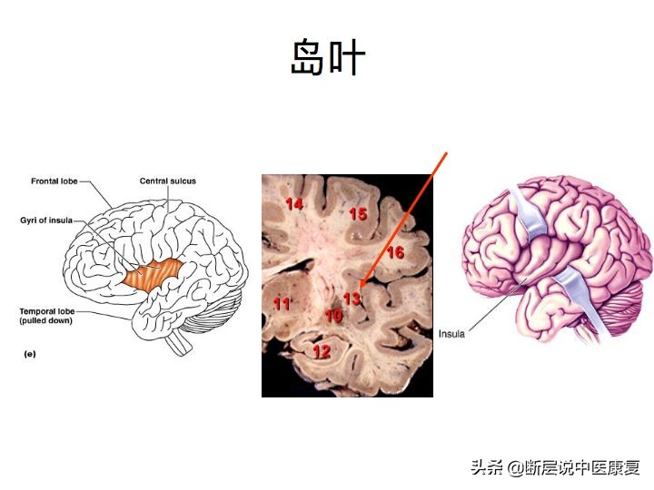 中枢神经系统断层解剖讲解,中枢神经3d解剖动画