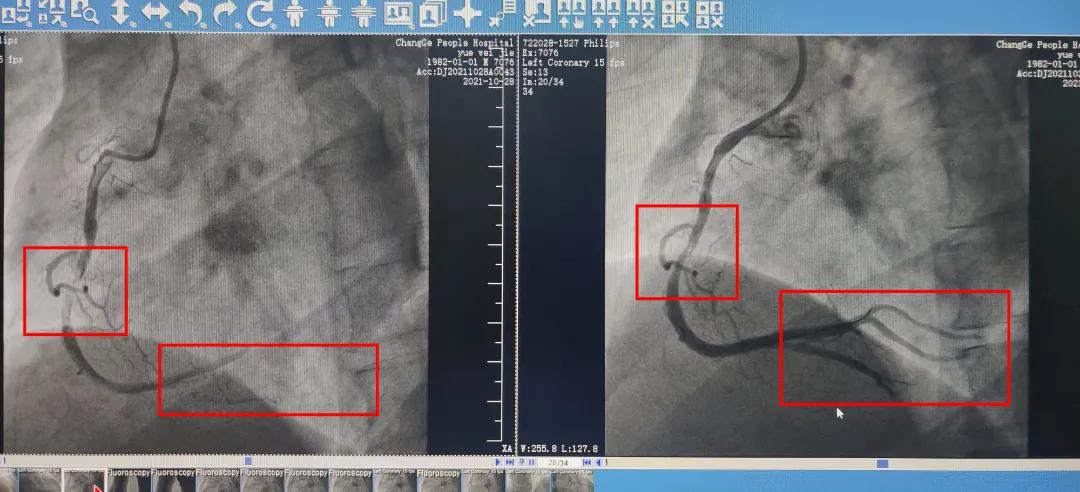 闀胯憶浜烘皯鍖婚櫌鏁戞彺鐜板満,闀胯憶鎵嬫湳