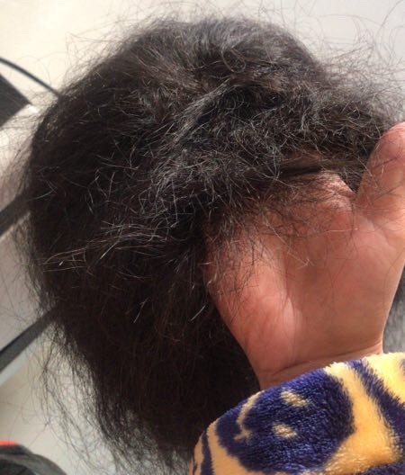 别让假发变成“钢丝球”！假发使用过程中一定不能这样做...