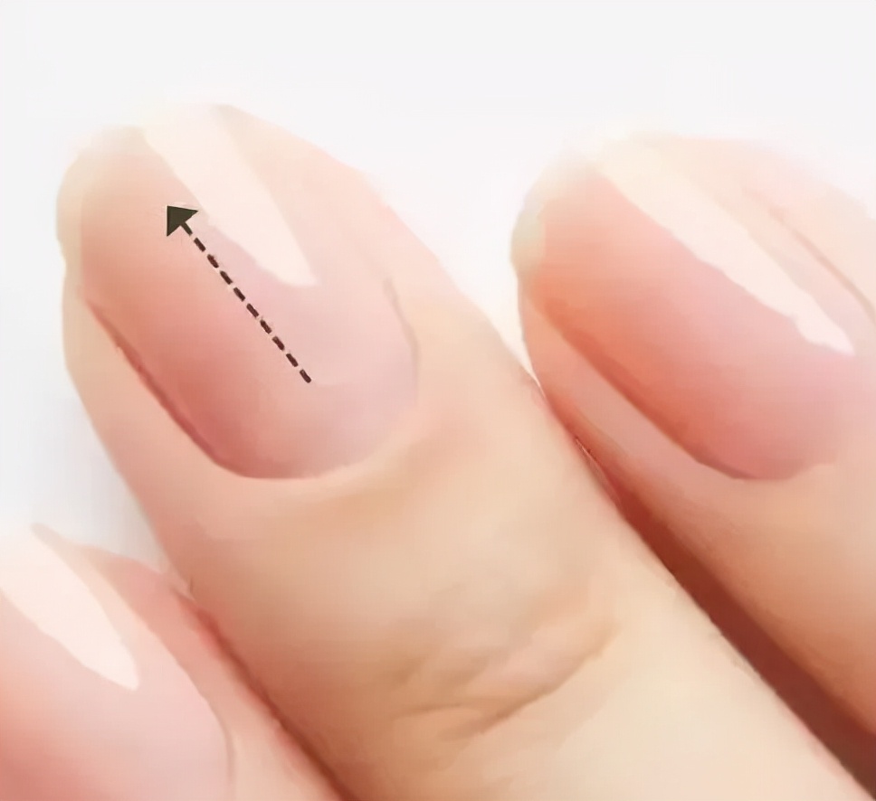 收藏！快速了解阿萝芬？一分钟学会