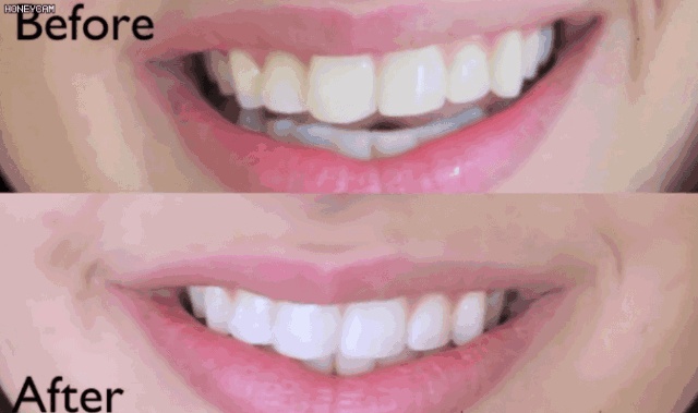 口红和牙齿,口红cp