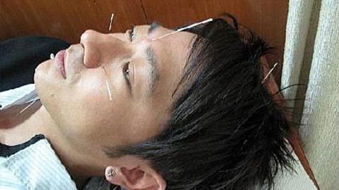 选择专业前你要知道的事,针灸的入门基础知识