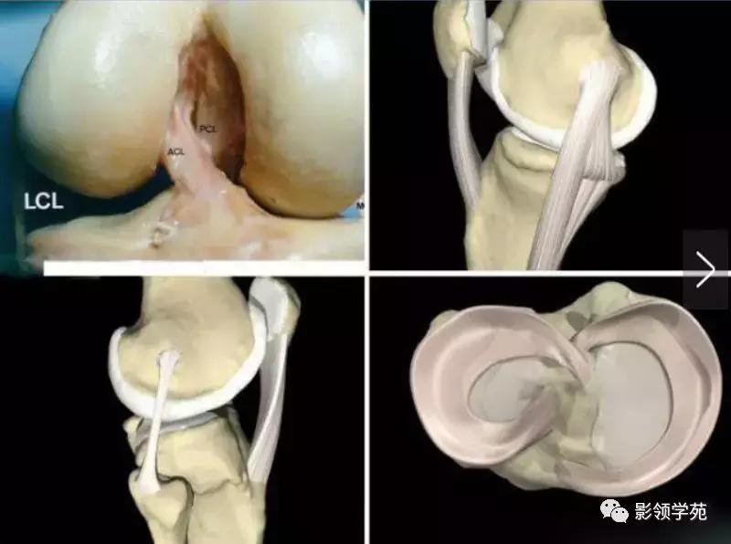膝关节疼痛的问题各种各样的图片,膝关节疼痛的16种最常见原因速查