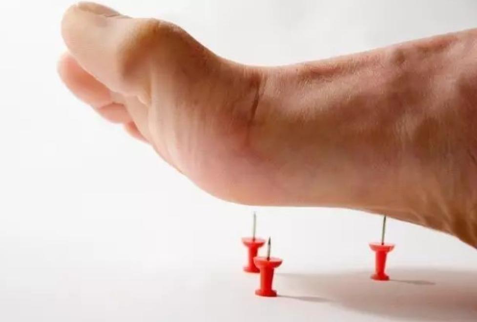 足底筋膜炎疼痛怎么处理,足底筋膜炎疼痛难忍怎么办