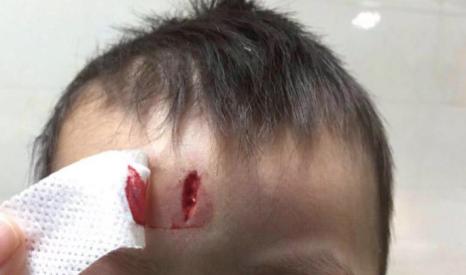 切菜不小心被刀口划了,手在切菜时被划伤了应该怎么办