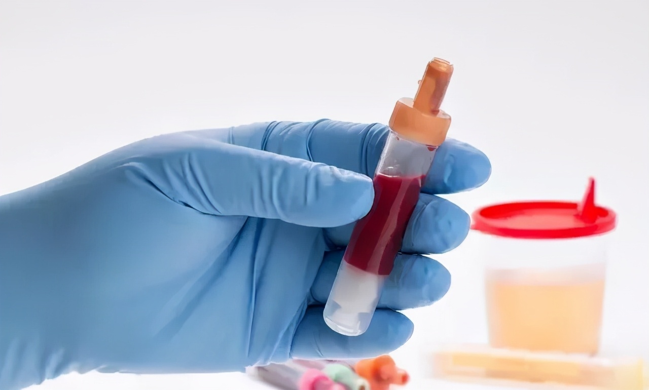 紫癜性肾炎一般多久可以好,紫癜性肾炎到底怎么治疗