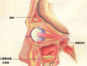 急性眼疾要注意什么,各种眼疾的症状