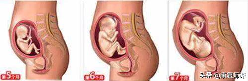 产后腹直肌分离恢复瘦肚子训练,产后腹直肌分离恢复的最佳方法