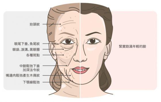 季泉玻尿酸面膜,季泉面膜多少钱一盒