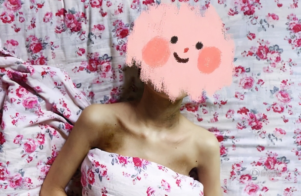 脾胃虚弱跟疳积的区别,积食和疳积的区别