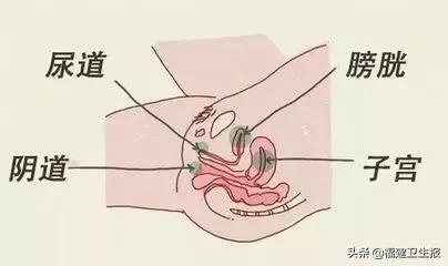 福建女子度完蜜月后出现尿频尿急，竟是患上这病！国庆刚结婚的要注意了！
