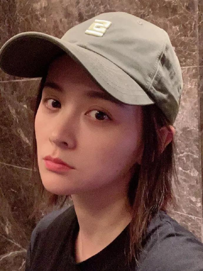 邓莎被烧伤原因,邓莎拔火罐被烧伤视频