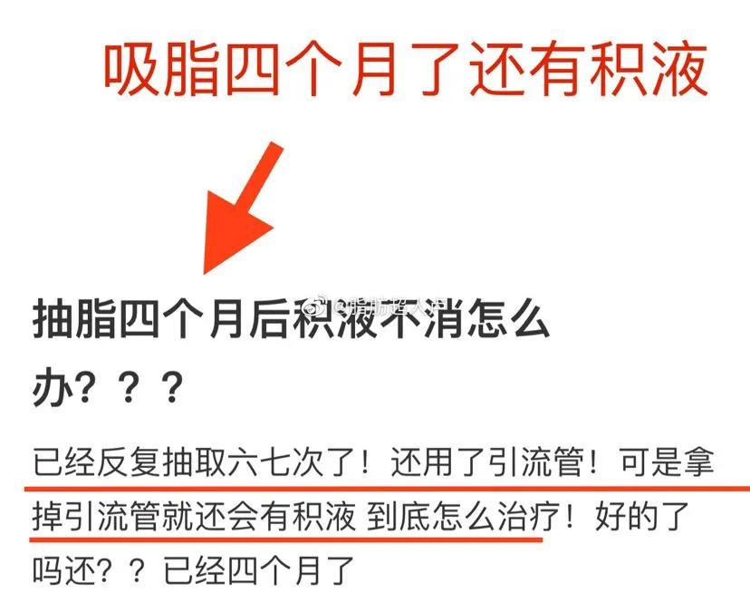 吸脂后腰部有积液抽一次,腰部吸脂一个月还有积液
