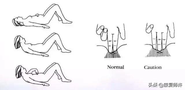 产后腹直肌分离恢复瘦肚子训练,产后腹直肌分离恢复的最佳方法