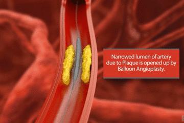 医生手术后最想做什么,医生做完手术以后会怎样