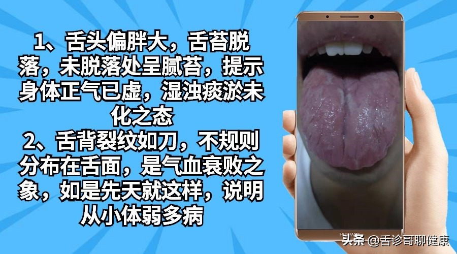 舌诊哥视频,抖音舌诊哥的感悟