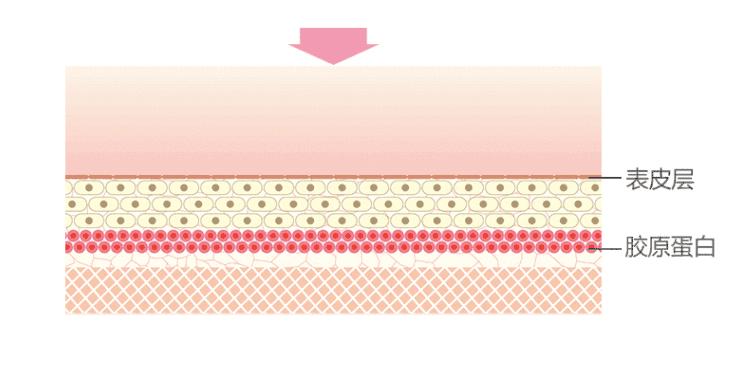 轻松学会选择正确的美容仪,美容仪器工作坑