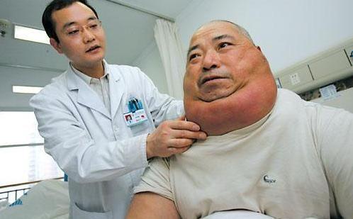 脂肪瘤长得快是要恶变吗,脂肪瘤怎么能确定是脂肪瘤